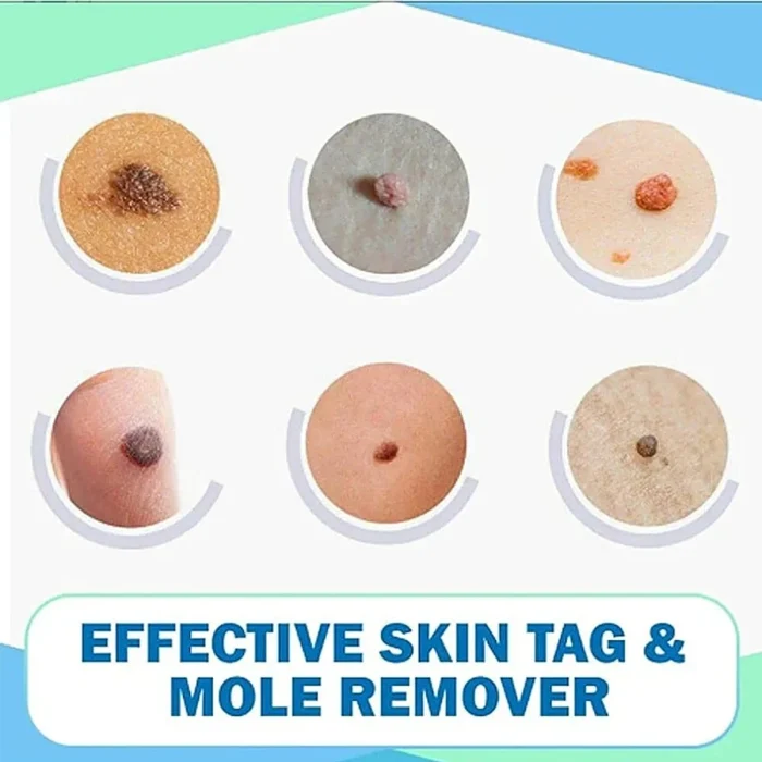 Anti-Acnes Gel - Image 2